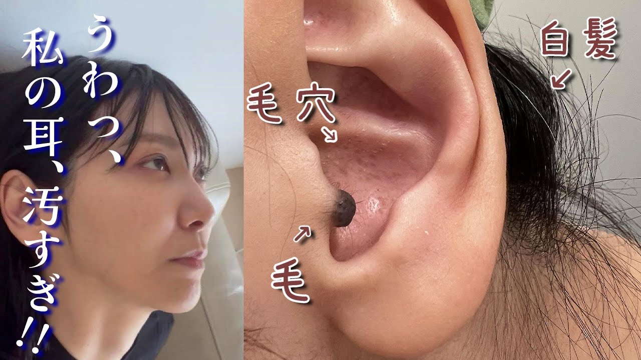みんな！自分の耳を見たことあるか？耳が汚すぎた女。