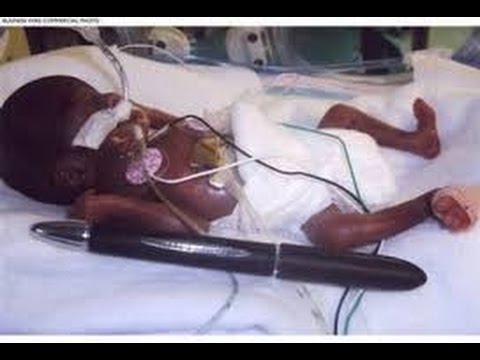 04-07-15-Clip 04-Myth of the Crack Baby-Global Black...