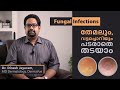 FUNGAL INFECTIONS OF SKIN | തേമലും, വട്ടച്ചൊറി (fungus) രോഗങ്ങളെ എങ