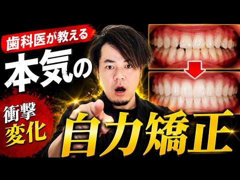【衝撃変化】歯科医が教える本気の自力矯正