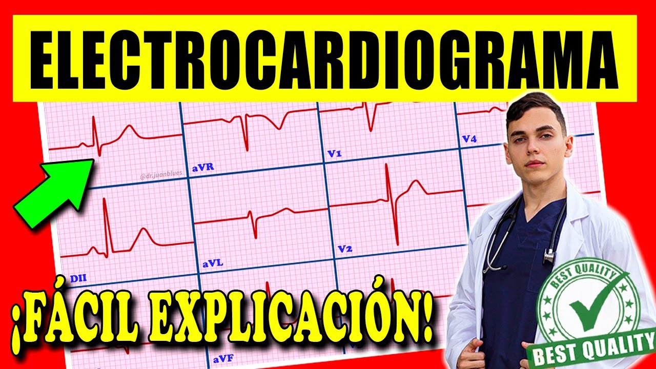 ELECTROCARDIOGRAMA Interpretación