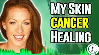 How Jamie Holmes Beat Stage 3 Melanoma - Melanoma Healing Story