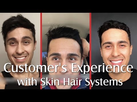 User Experience of 3 Skin Hair System