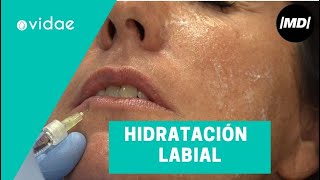 Tratamiento para la hidratación de labios
