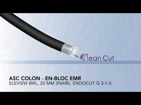 Colonoscopia - RME de colon ascendente - inyección de Eleview