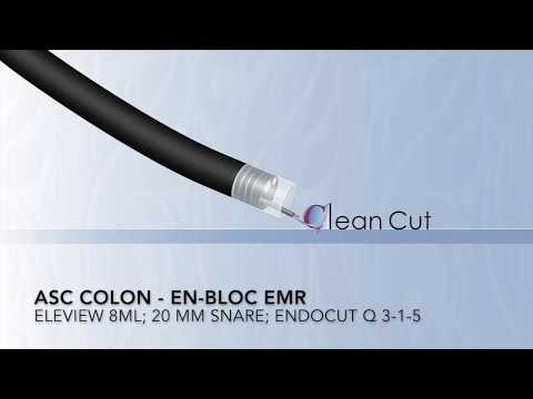 Résection muqueuse endoscopique (EMR)  du polype du colon ascendant 