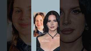 What Happened To Lana Del Ray’s Face?