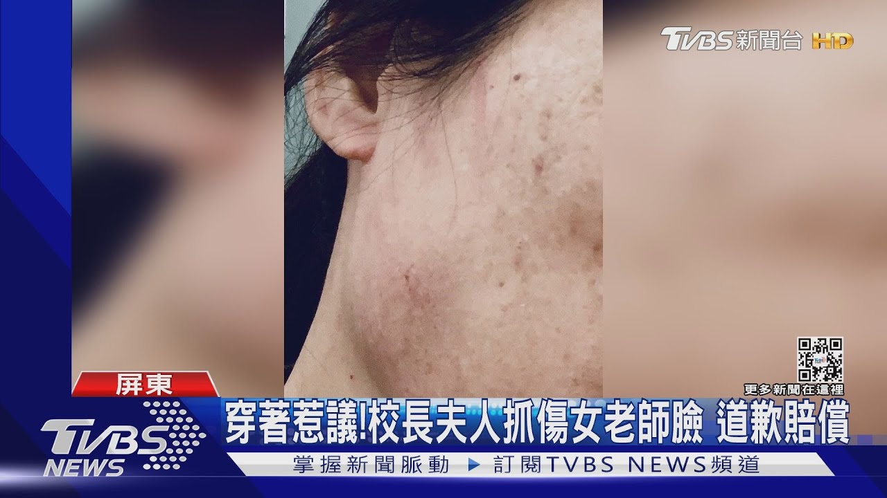 穿著惹議!夫人穿馬靴、豹紋包抓傷女老師道歉賠償 校長自請處分