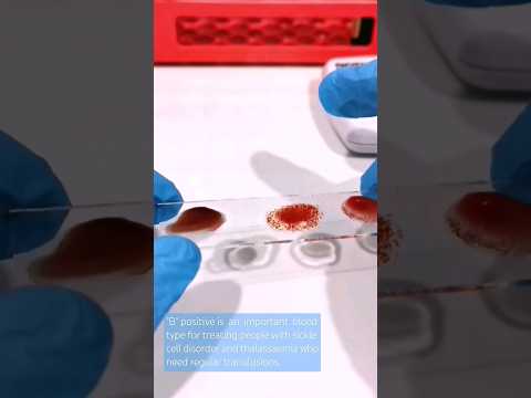 Facts about "B" positive blood type