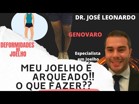 DOR NO JOELHO : Doutor, Meu Joelho é Arqueado! O que fazer?