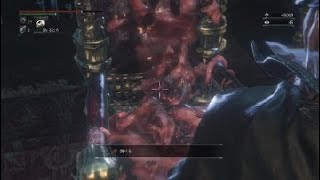 アルフレートすぎたbloodborne