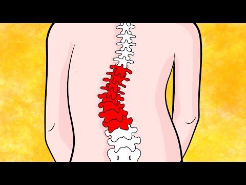 How to Fix Lumbar Scoliosis in 4 minutes naturally
