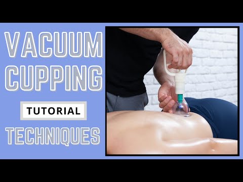 Cupping Massage - Back Treatment