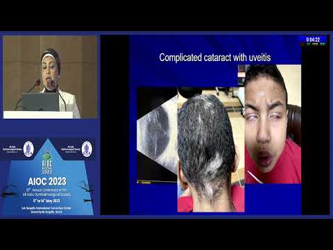 AIOC 2023   IC47   topic Dr Nihal Adel Hassan  Keynote Address