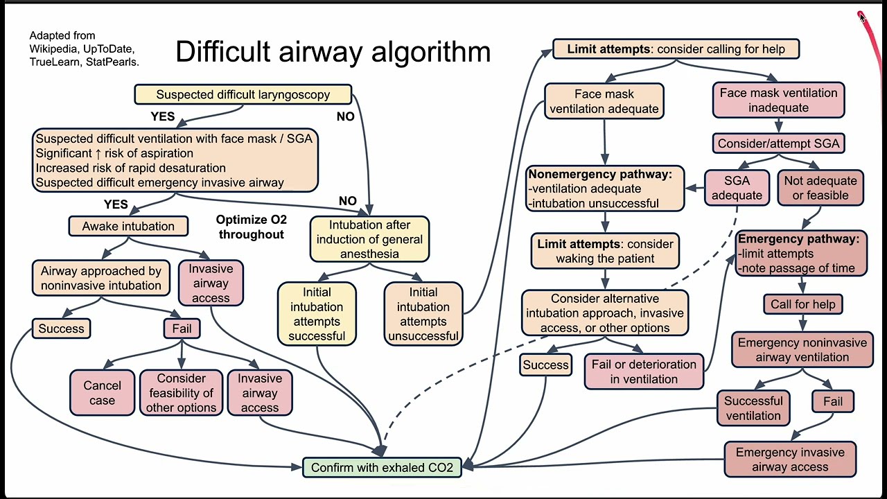 Difficult airway algorithm