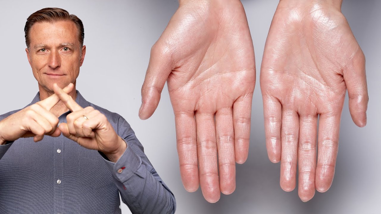 How to Stop Excessive Sweating (Hyperhidrosis) - YouTube