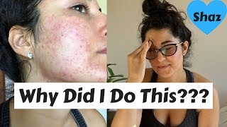 I Waxed My Face and This Is What Happened - TERRIBLE ACNE