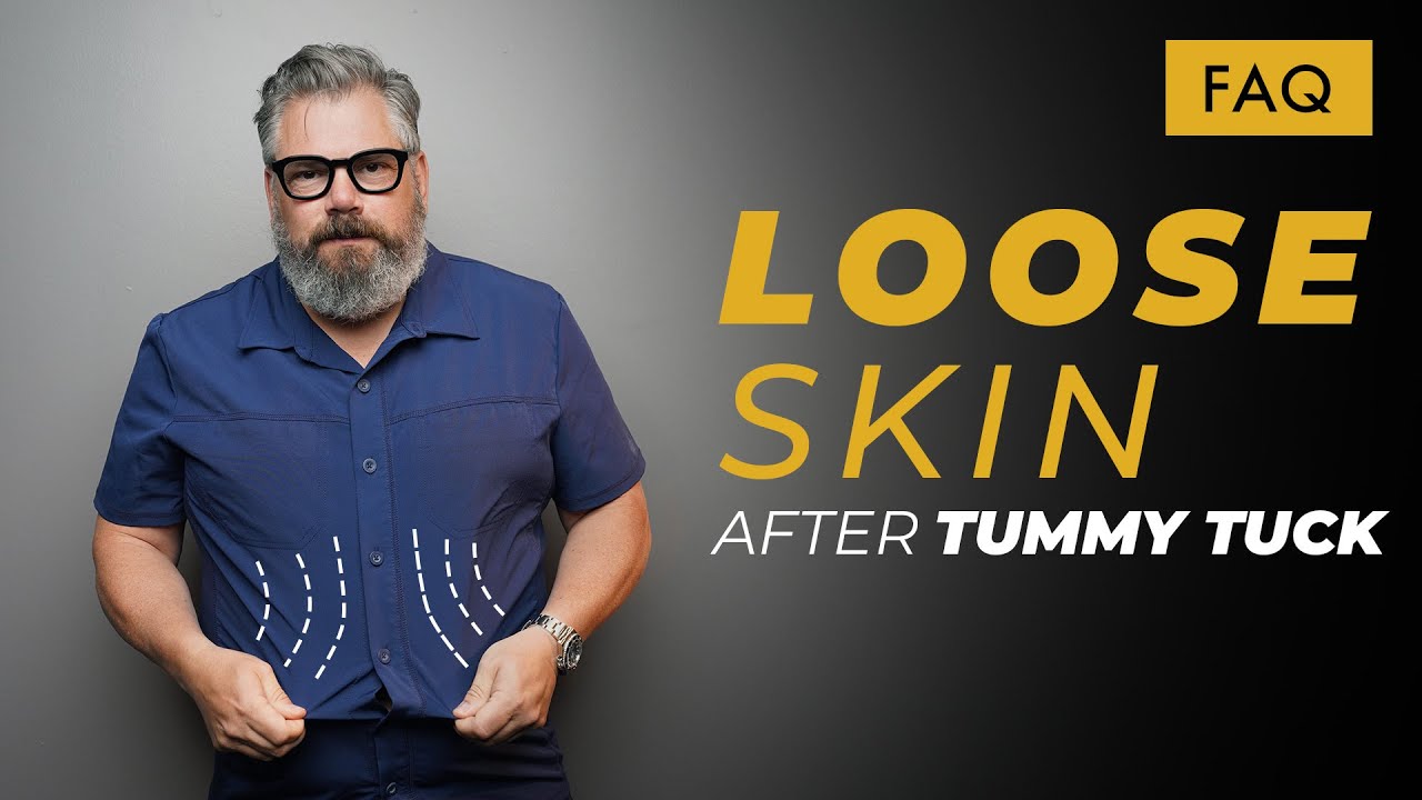 Can you Continue to Have Loose Skin AFTER a Tummy Tuck?