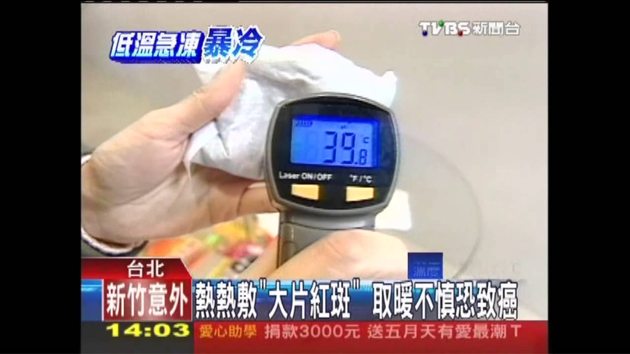 熱熱敷「大片紅斑」 取暖不慎恐致癌