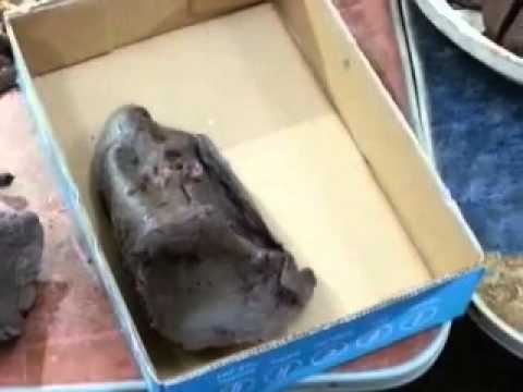 thorax (3) lung 1st grade Dr-Ayman Abdalla