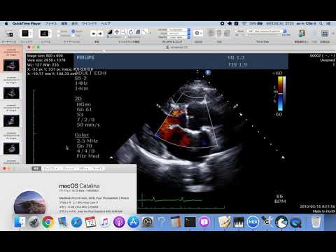 保健学科 HorliX on OSX Catalinia