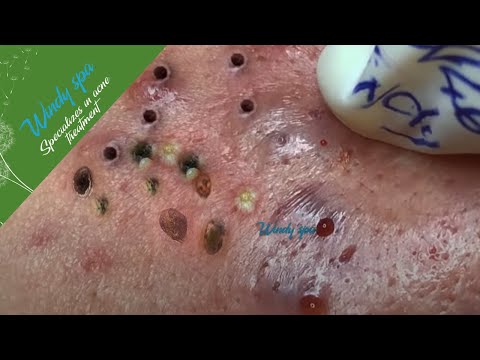 Make Your Day Relaxing with Windy Spa 6#110