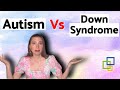 What S The Difference Between Autism Down Syndrome