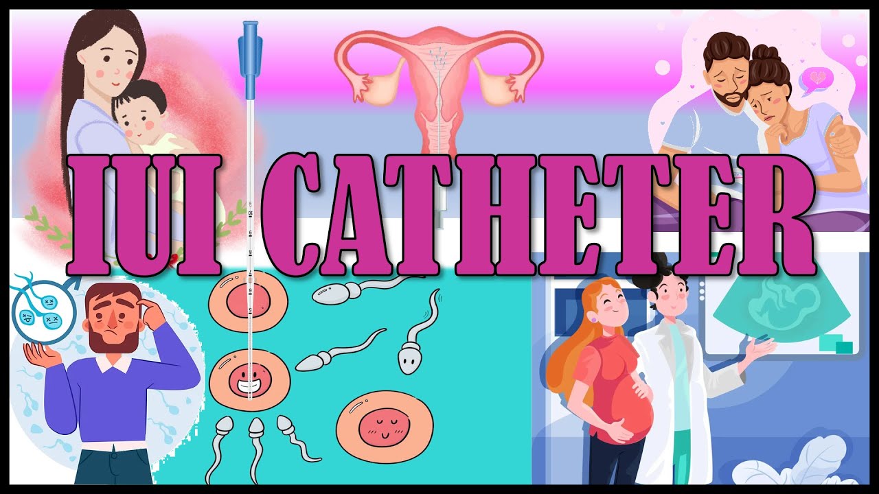 IUI catheter (INTRA UTERINE INSEMINATION CATHETER)