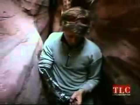 Aron Ralston describes the amputation