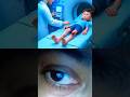 Chintu Ke Pairon Ki Haddi Kaise Tut Gaye Chhote Bacchon Ka Cartoon Video Viral And Trending