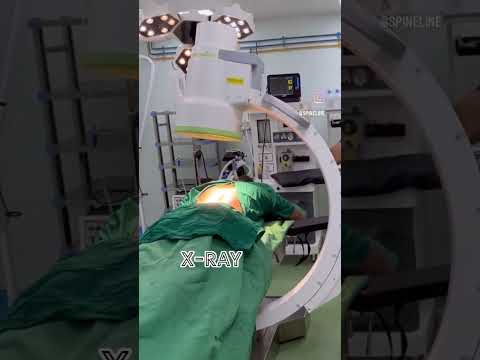 Use of X-ray machine during spine surgery!