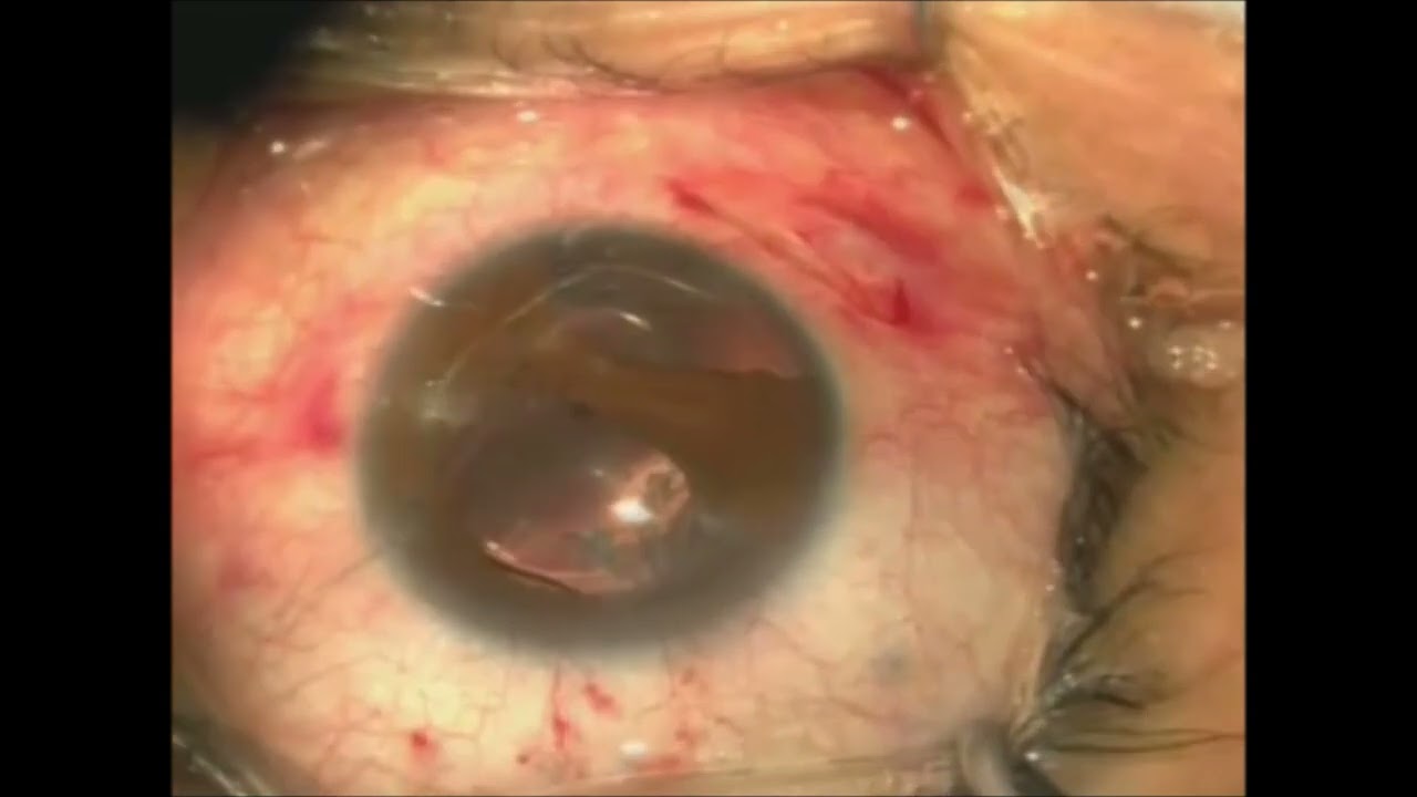 Miguel Angel Ibañez Hernandez-32