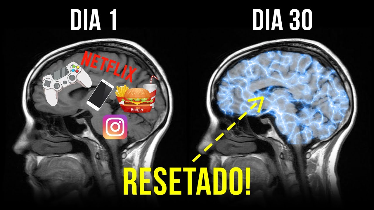 Após Isso O Seu Cérebro Será Resetado! | Psiquiatra Dra. Anna Lembke