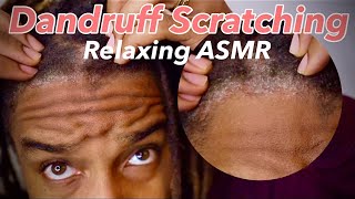 Removing Flakes and Dandruff From Dreadlocks | Extremely DRY SCALP - Seborrheic dermatitis (Before)