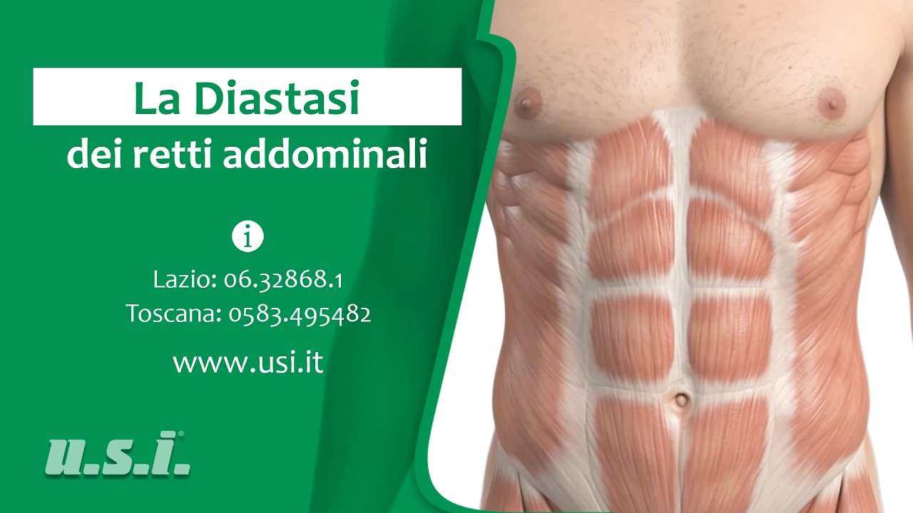 USI - Diastasi ed Ernie: diagnosi, trattamento e chirurgia mini-invasiva della parete addominale
