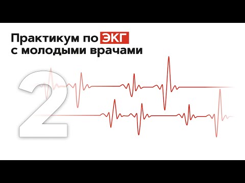 Практикум по ЭКГ с молодыми врачами. 11.01.22