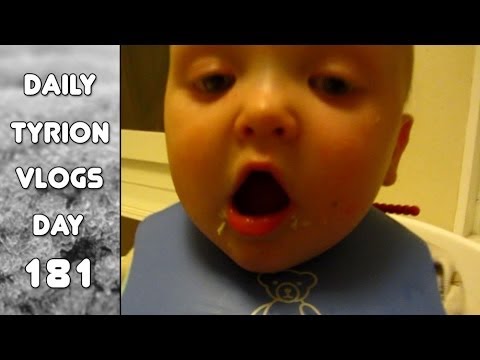 Where Are Your Teeth? (day 182)