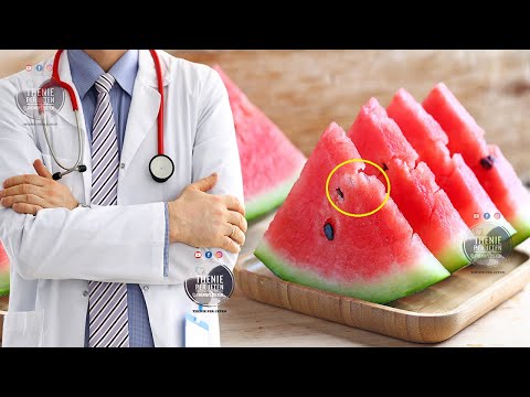 Hani këtë frut çdo dit esëll, hidraton lekuren, forcon kockat dhe mbron zemren