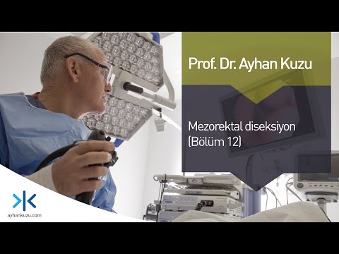 Mezorektal Diseksiyon: Bölüm 12 play