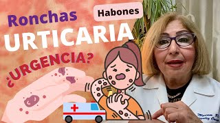 URTICARIA, RONCHAS o HABONES. ¿Realmente una URGENCIA