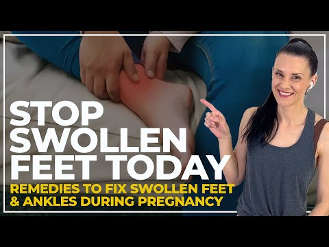 Swollen Feet Pregnancy FIX  (STOP Pregnancy Edema Fast!)