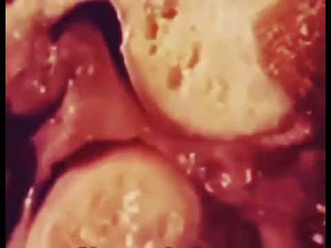 Aprigio Zangerolami-13