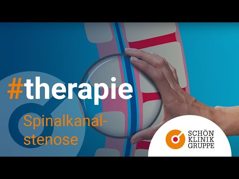 Wie man die Schmerzen einer akuten Anfall von Osteoarthritis entfernen Artropant Salbe für Gelenke kaufen