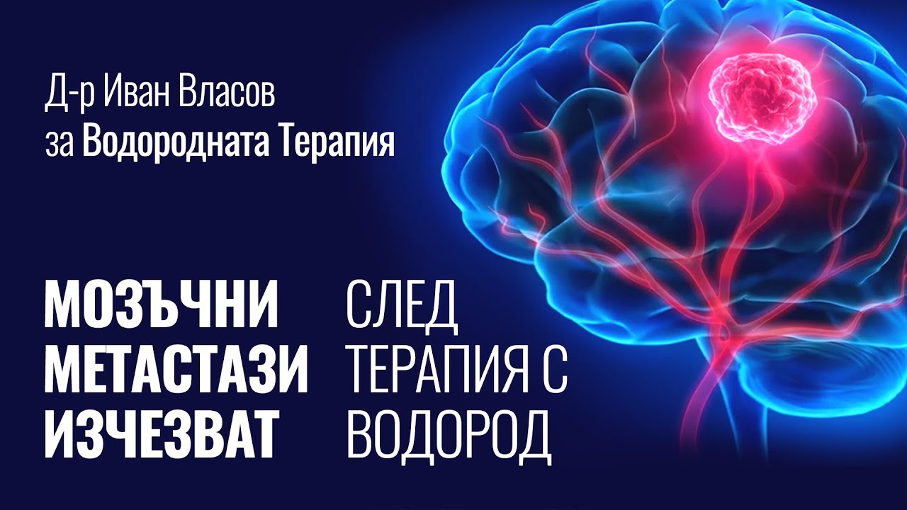 Мозъчните метастази изчезват след вдишване на Водород