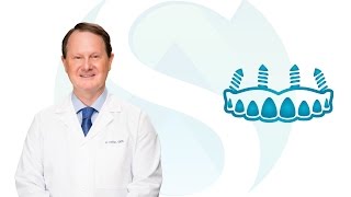 Full-Arch Restoration in Sioux Falls SD: Dr. Miller | Siouxland Oral & Maxillofacial Surgery