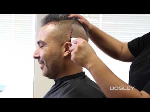 BOSLEY FUE (Follicular Unit Extraction): Hair-by-Hair Restoration from Bosley (How it's done)