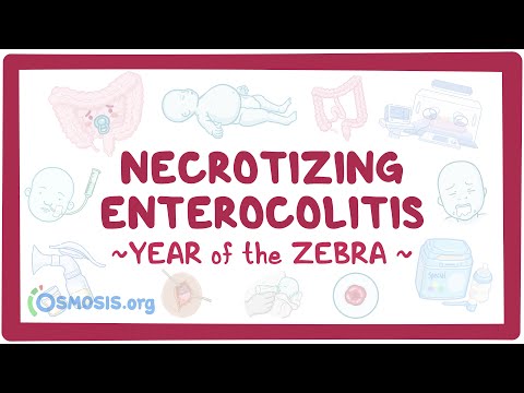 Necrotizing enterocolitis (Year of the Zebra 2024)