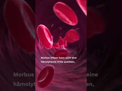 Morbus Wilson #gesundheit #shorts #leber  #krankheit