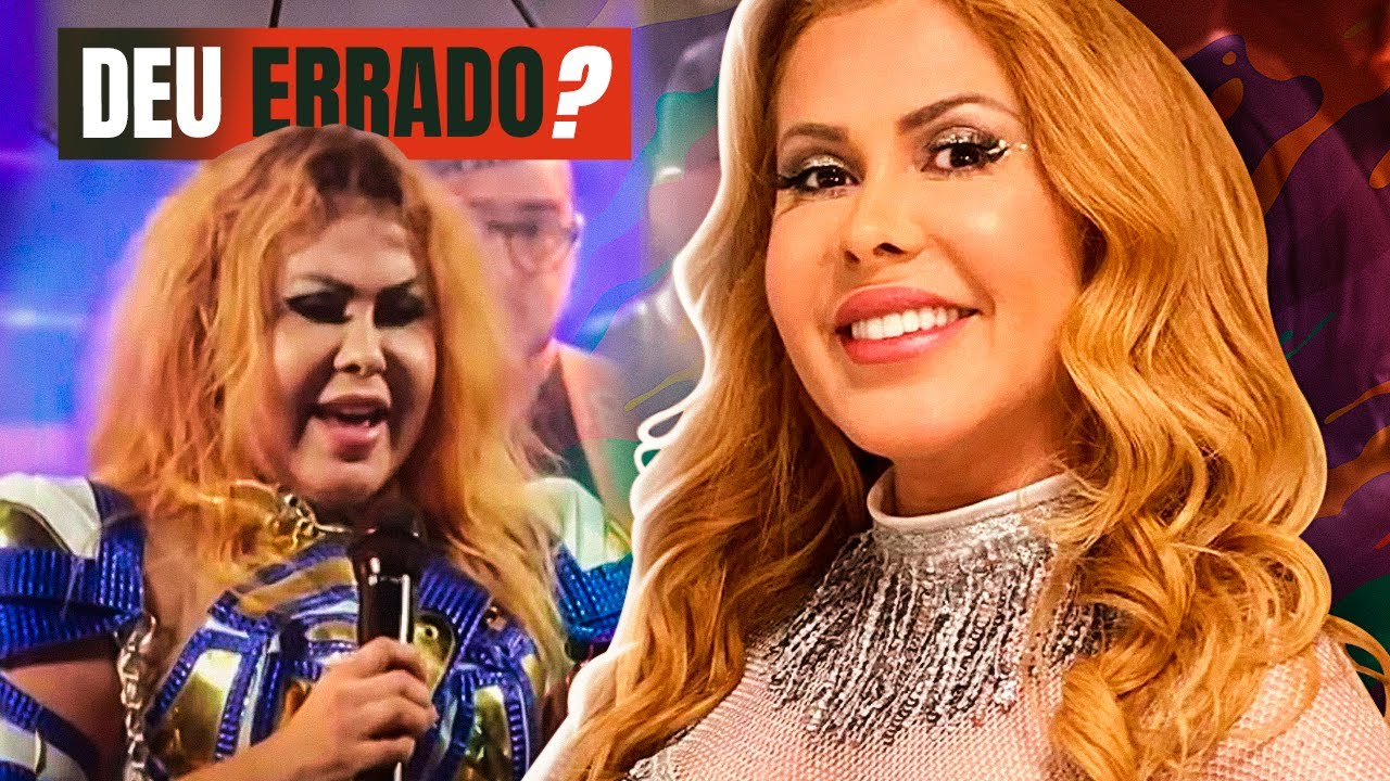 FAMOSOS QUE EXAGERARAM NA HARMONIZAÇÃO FACIAL #3