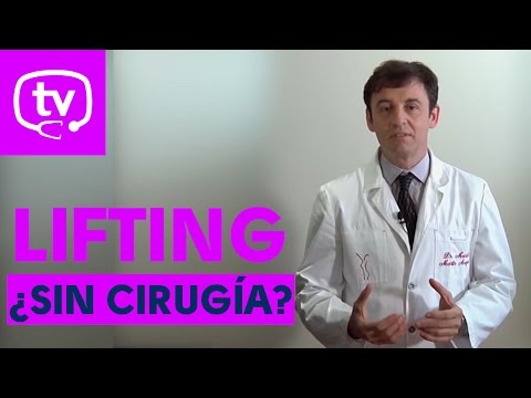 Lifting sin cirugía ¿es posible?